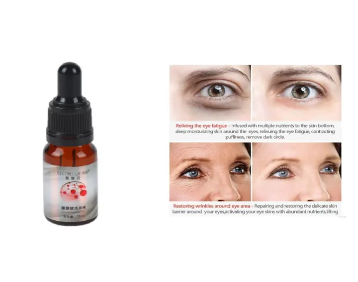 niacinamide for dark circles