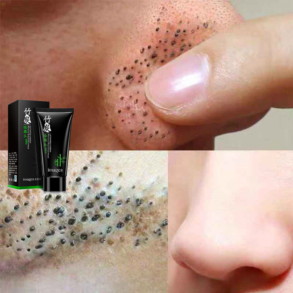 Gambar Penjualan Terlaris Deep Cleansing Peel Off Hitam Lumpur Penutup Masase Muka Menghilangkan Komedo Masker Wajah De Soin Charbon Anne