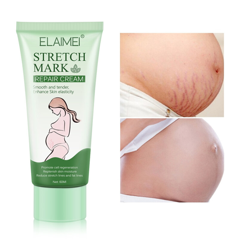 Kem Xóa Sẹo Kem Trị Sẹo Cho Bà Bầu Rạn Da, Thuốc Mỡ Cải Thiện Làn Da Xỉn Màu, Dành Cho Eo Bụng Đùi giá rẻ