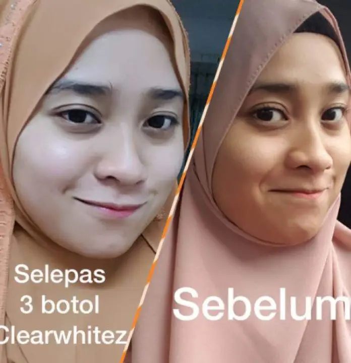 clear whitez skin booster