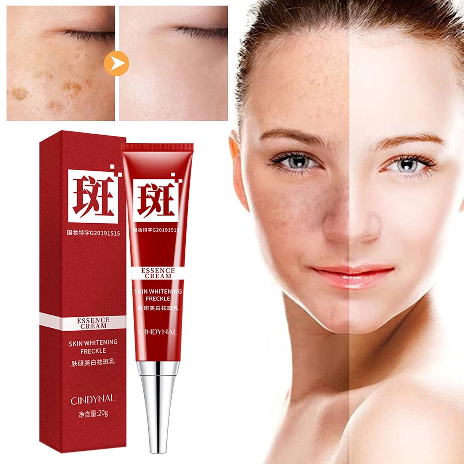 Whitening Freckle Cream Remove Face Skin Care Chloasma Remove Dark Spots Melanin Melasma Cream whitener Brighten Skin Anti-Aging