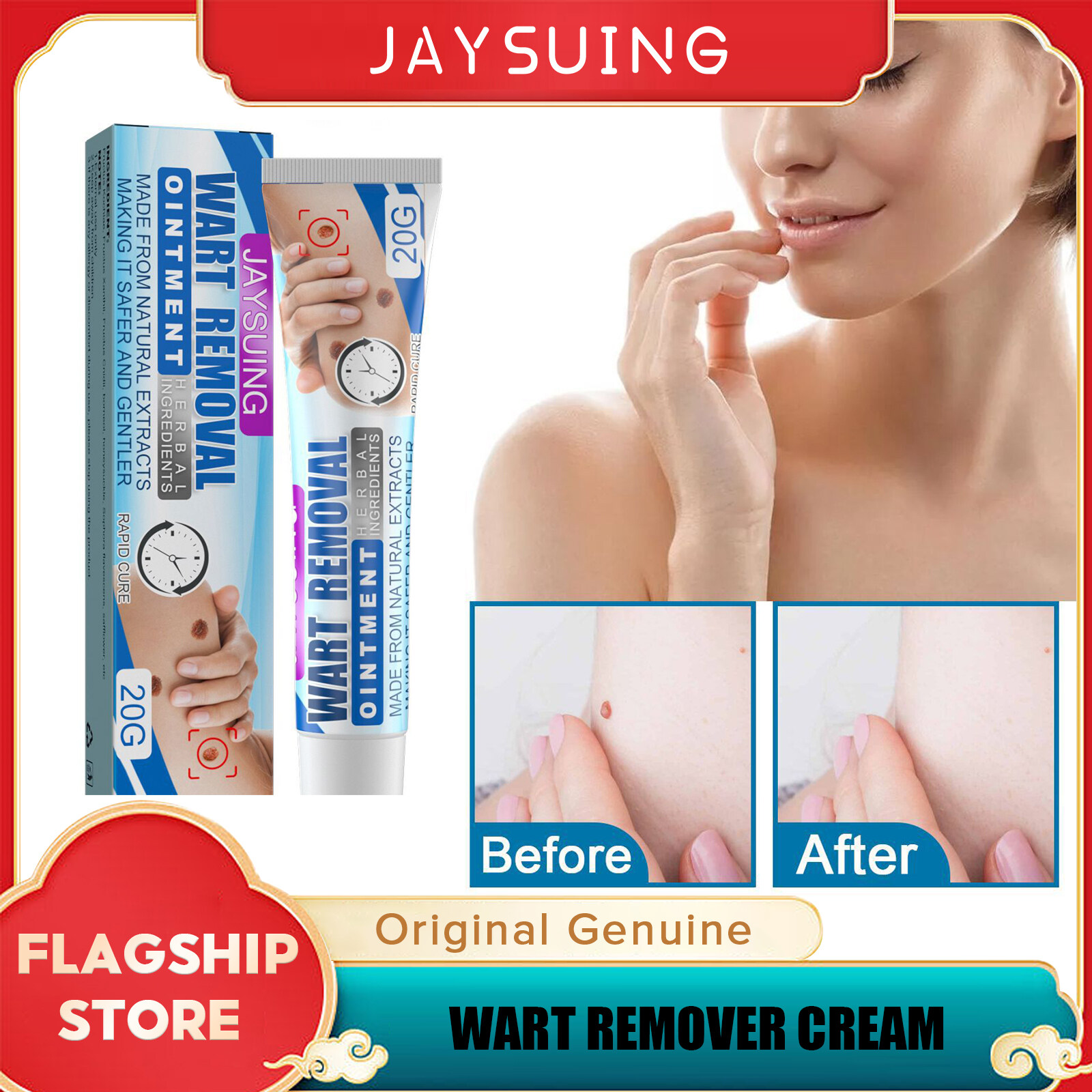jaysuing-wart-remover-cream-warts-remover-liquid-antibacterial-ointment