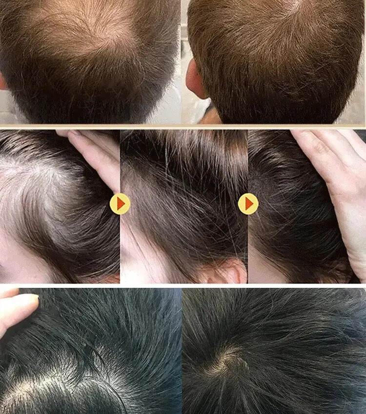 Jinli OUHOE ginger hair growth shampoo | Lazada