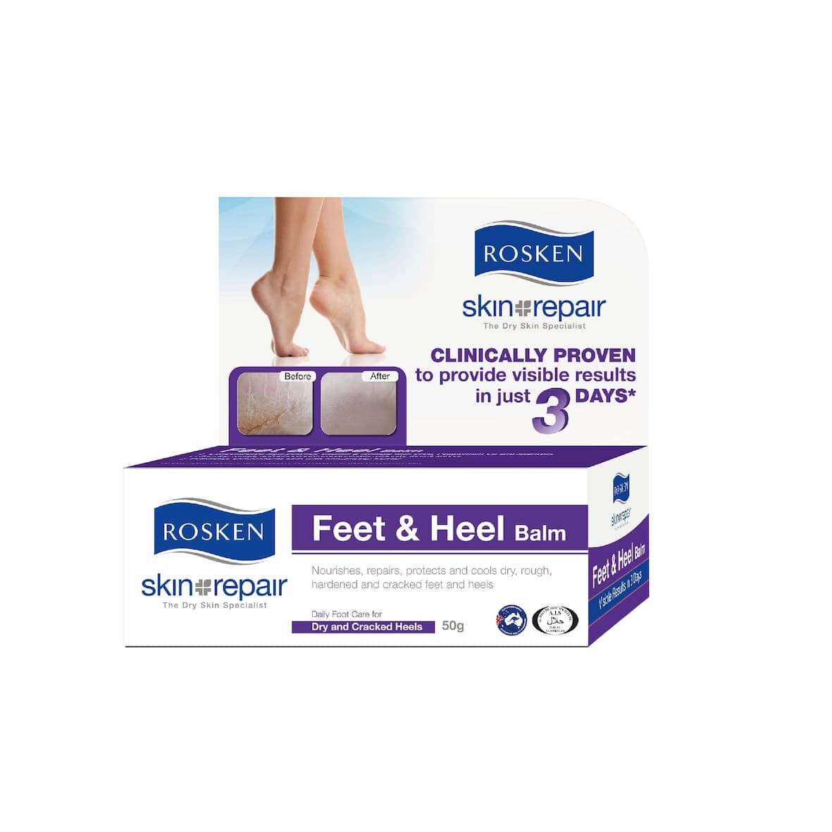 Rosken Skin Repair Feet Heel Balm (50g) Lazada - Main Image