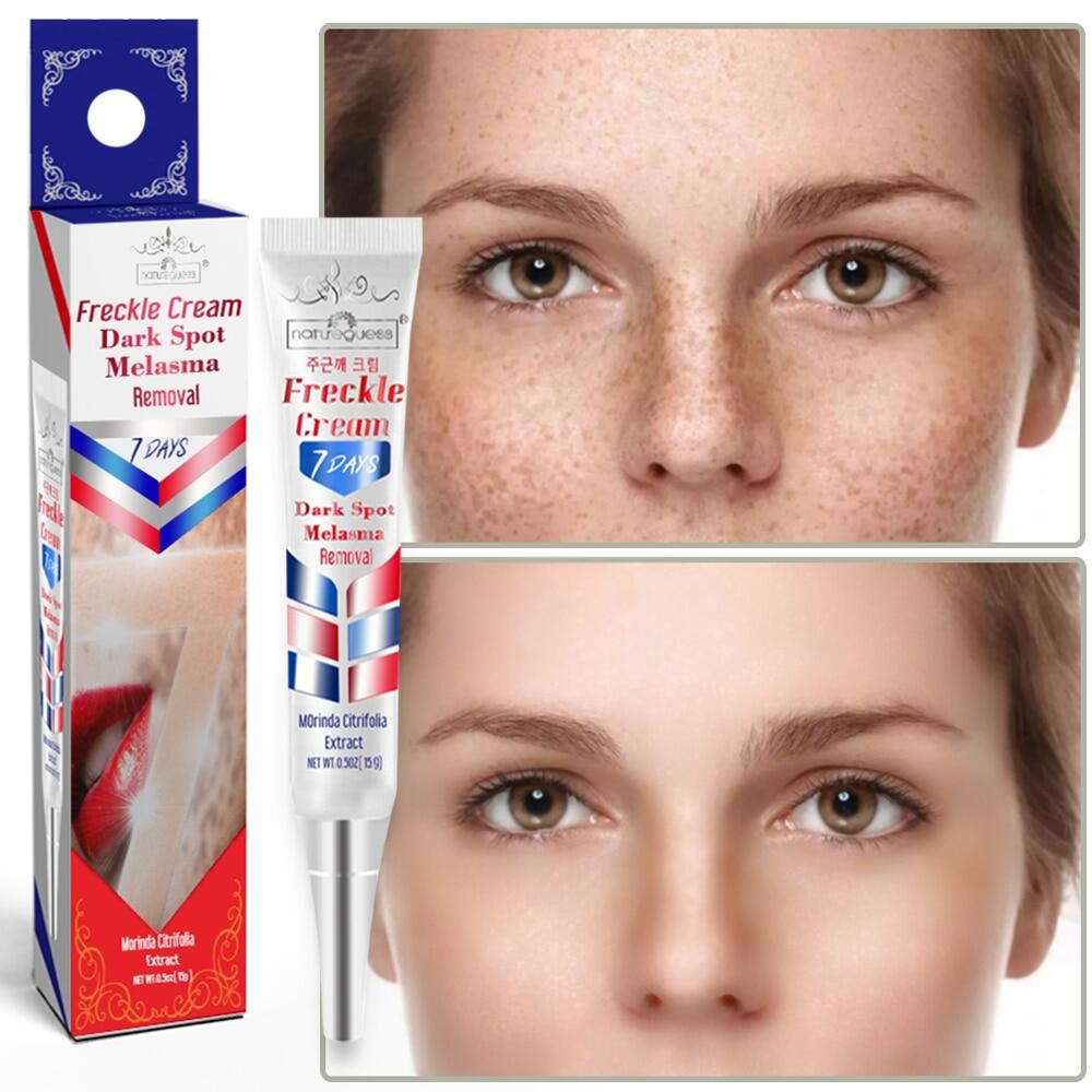 Effective Whitening Freckle Cream Remove Melasma Acne Spot Pigment Melanin Dark Spots Pigmentation Moisturizing Gel Skin Care