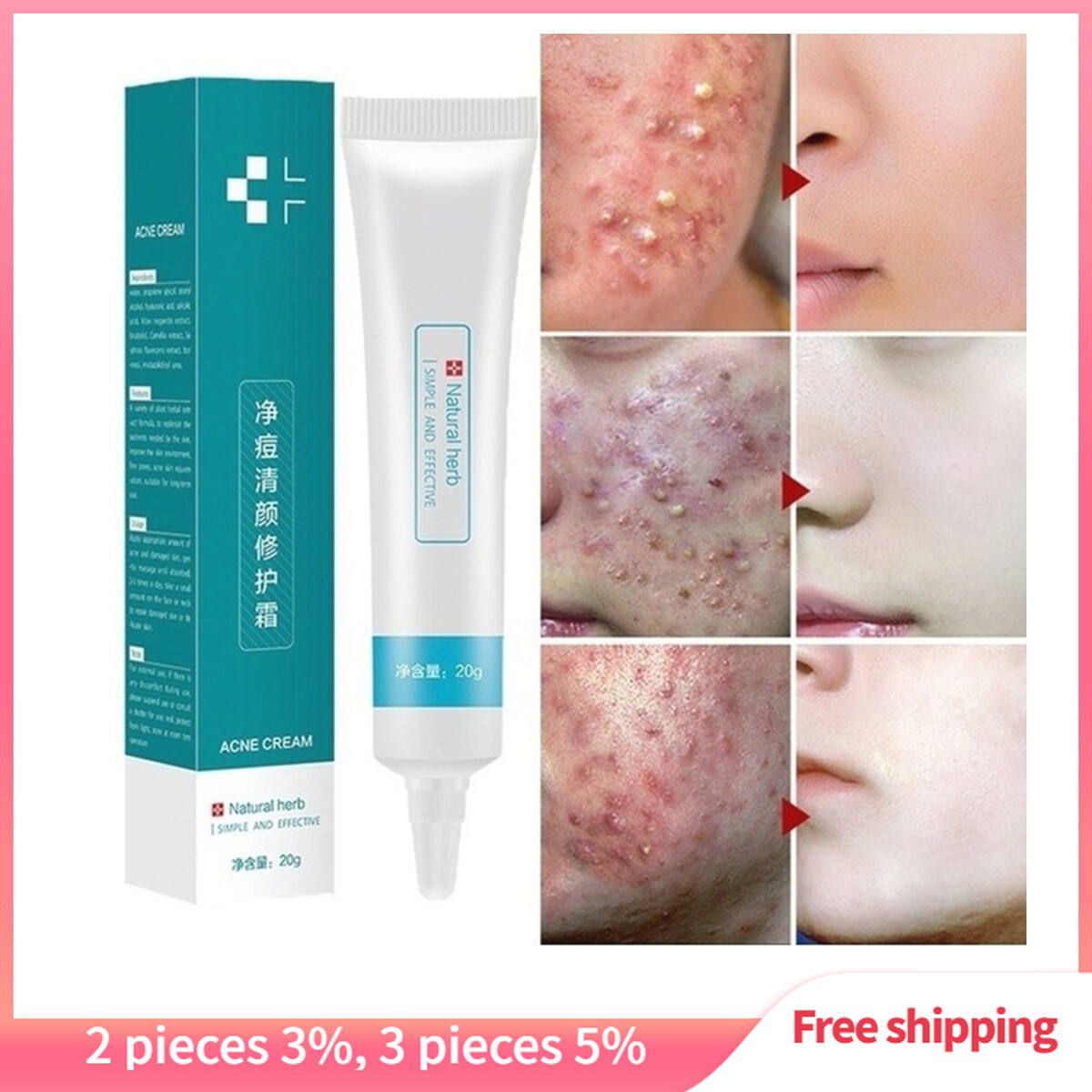 whitening acne cream