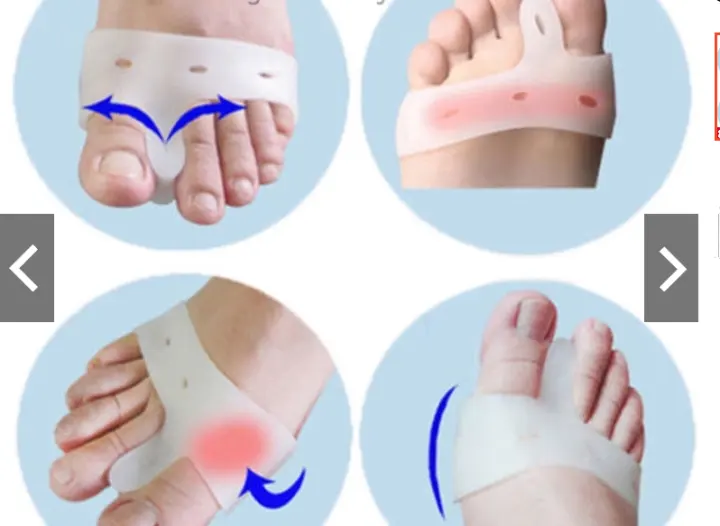 1 Pair Silicone Socks Toe Separator Feet Care Gel Bunion Pads Pain Relief Hallux Valgus Orthotics Pro Correction Foot Care Tool Skin Pair Silicone Orthotics Toe Separators Kamal Online Store Lazada The no.1 website for pro audio. lazada
