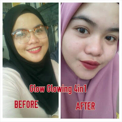 glow glowing skincare testimoni