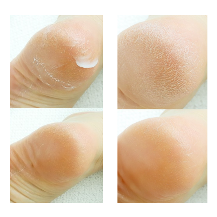 [NEUTROGENA] Intense Repair Foot Cream 56g