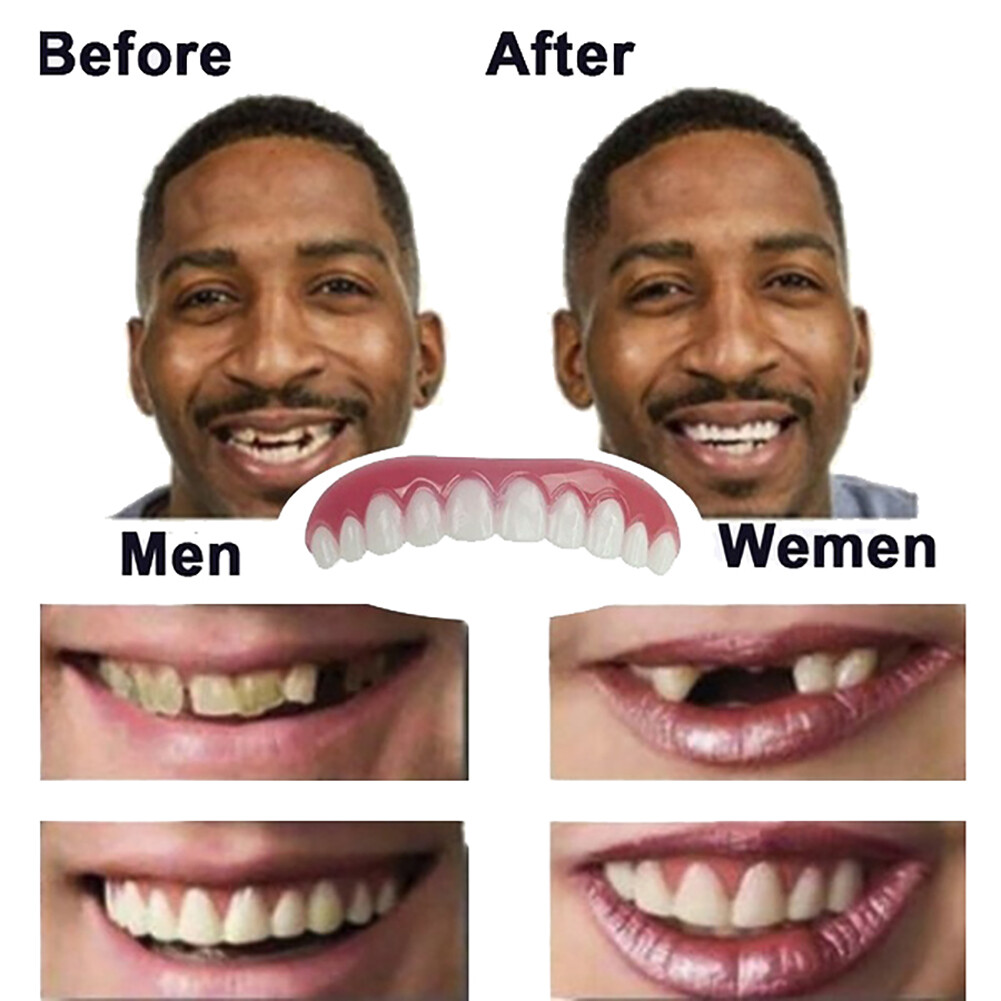 Silicone Nụ Cười Mỹ Phẩm Răng Chụp Trên Phía Trên An Toàn Flex Nha Khoa Veneers