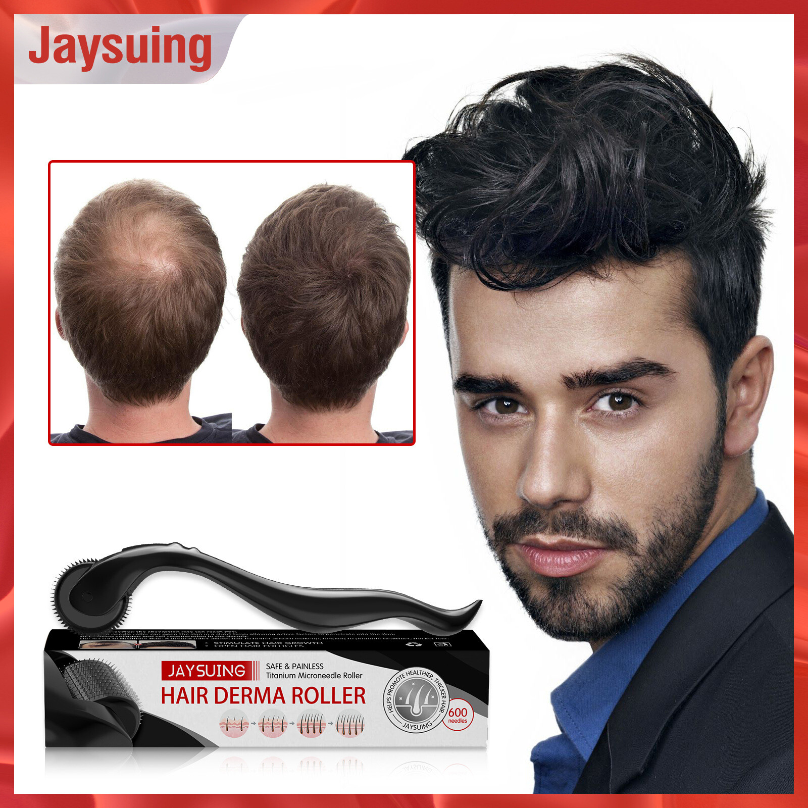 Jaysuing Natural Men Hair Beard Growth Derma Roller Micro Needle Dermaroller Hair Regrowth Anti Hair Loss Treatment Micro Needle Roller Derma Roller Dermaroller Titanium Hair Regrowth Beard Growth Anti Hair Loss Treatment Thinning Receding