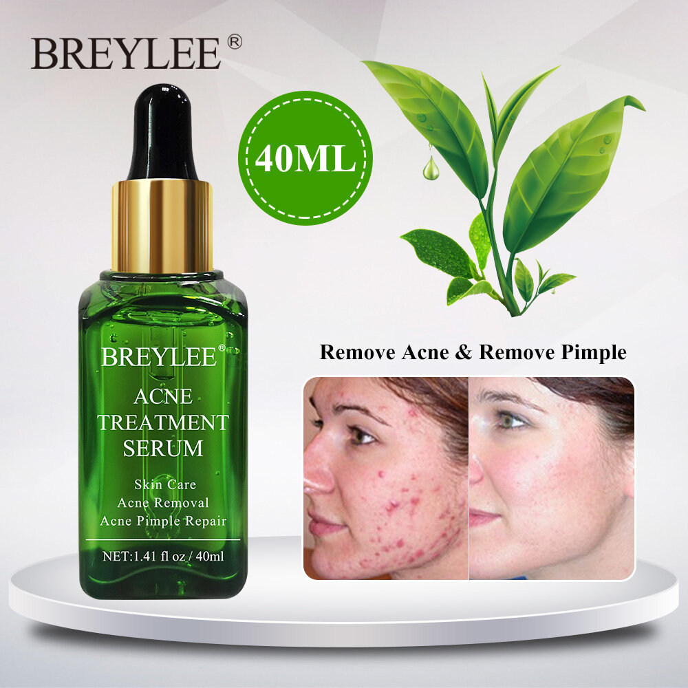 breylee acne treatment serum