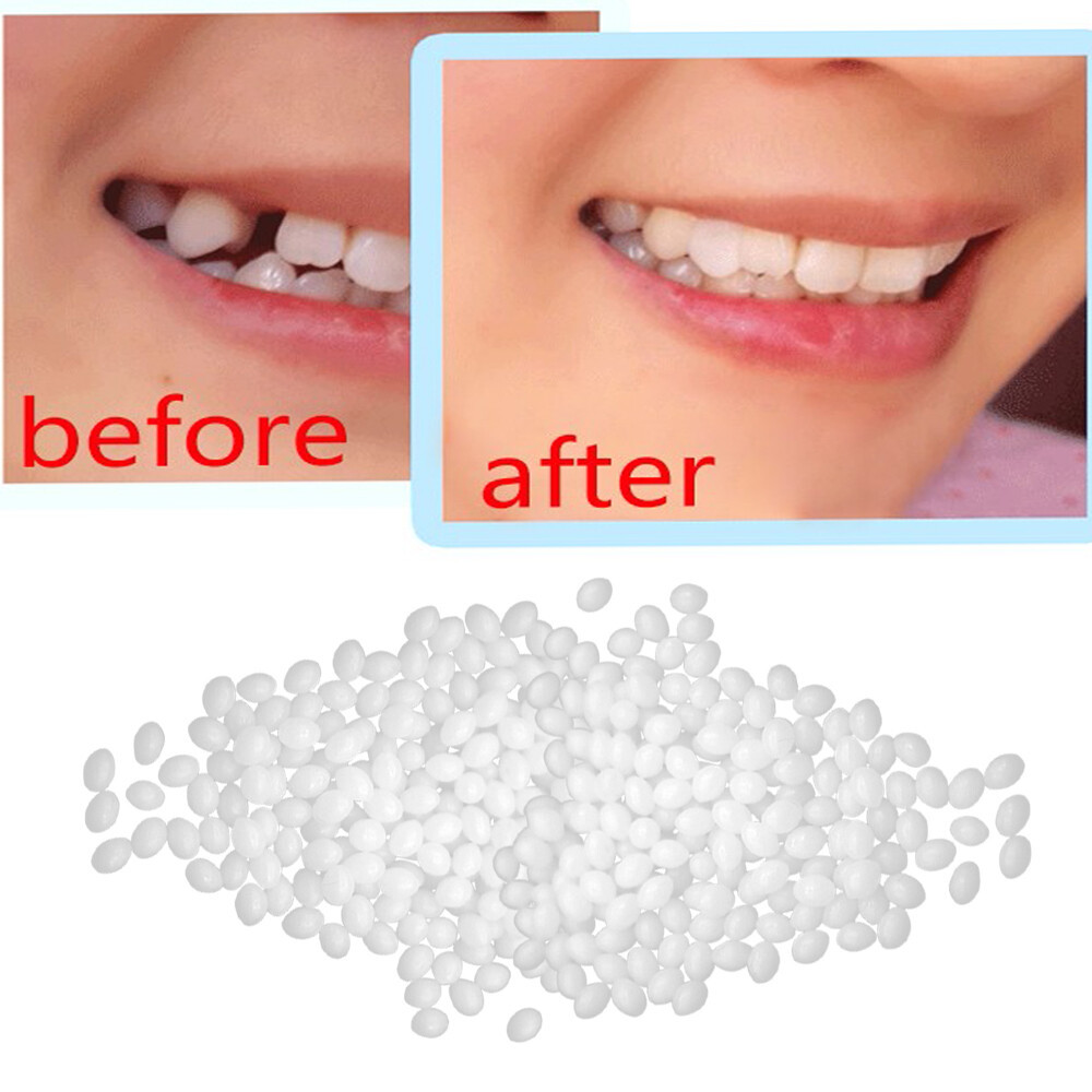 Vật Liệu Thay Thế Răng Hàm Răng Hàm Hàm Răng Giả Răng Giả Răng Hàm Bộ Đồ Nghề Điện Răng Hàm Thay Thế Nha Khoa Thay Thế Keo Gel Răng Răng Hàm Rắn