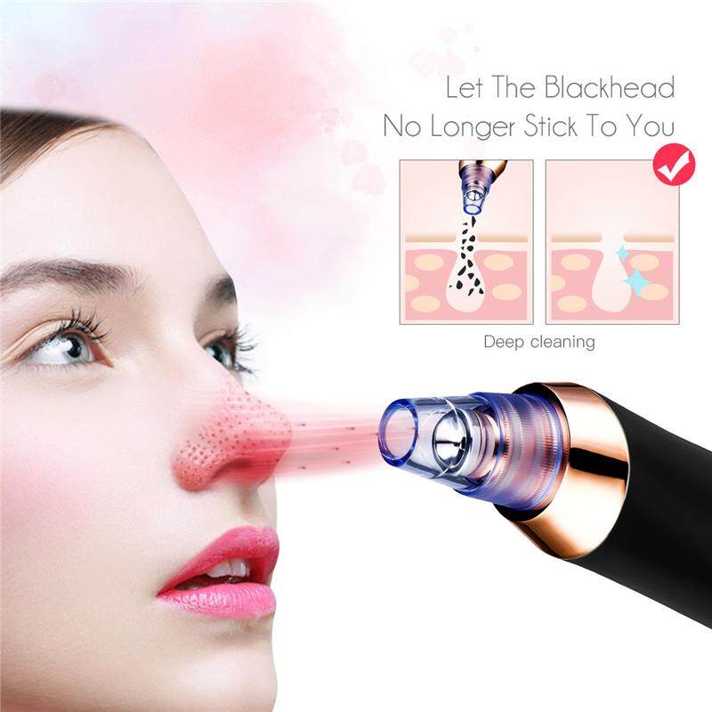 CkeyiN USB Rechargeable Vacuum Suction Blackhead Remover Facial Pore
