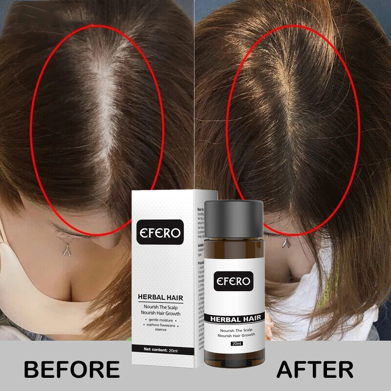 Tinh Dầu Mọc Tóc Nhanh, Tinh Dầu Giúp Phục Hồi Tăng Cường Mọc Tóc Dày Đặc Có Sẵn Hàng Chính Hãng