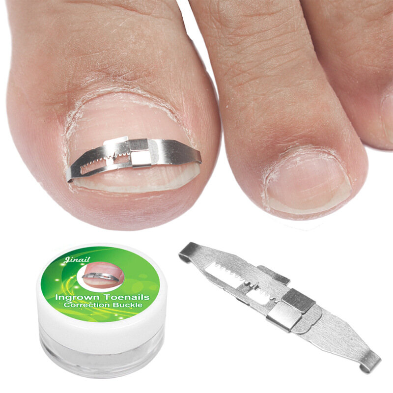 【 100% gốc + COD】Ingrown Chân Móng Tay Công Cụ Chỉnh Sửa Móng Chân Thẳng Hiệu Chuẩn Vá Bộ Công Cụ