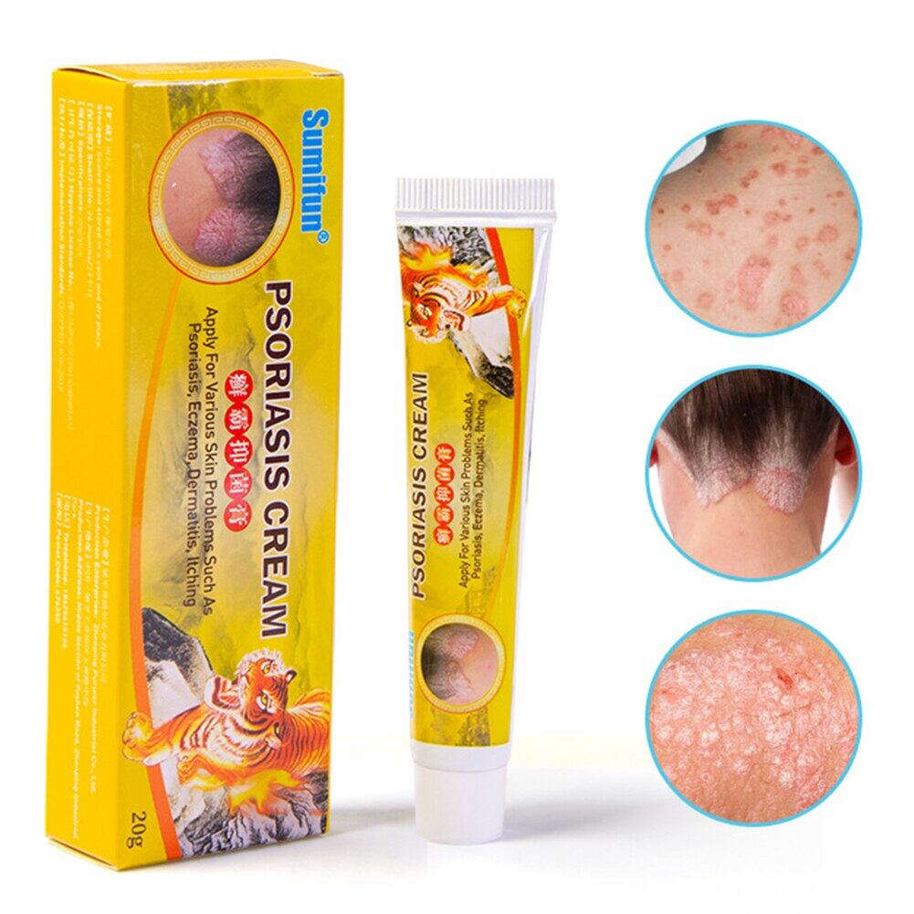Psoriasis Cream Eczema Ointment Scalp Psoriasis Hand Tinea Foot Odor