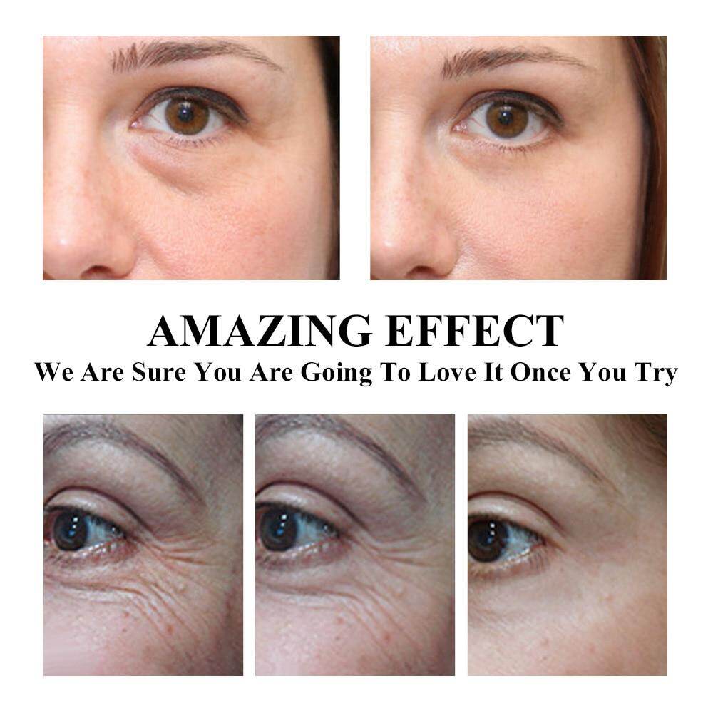breylee retinol eye cream