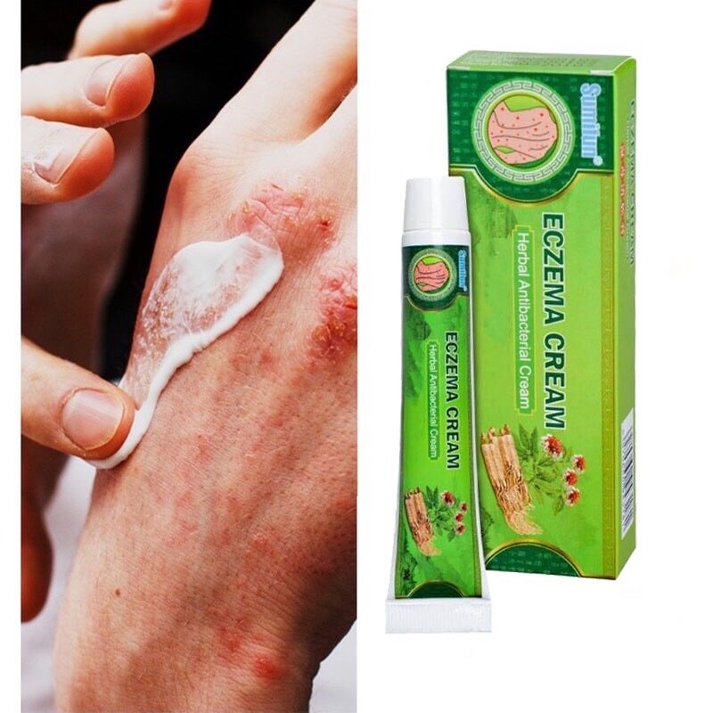 promo SUMIFUN ECZEMA CREAM Krim Rawatan kulit Rawat ekzema Kurap panau ...