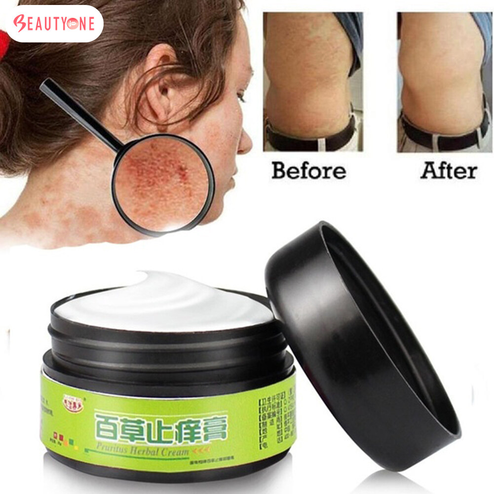 【COD】 Mupirocin Ointment Fungisol Anti Fungal Cream Dermovate Ointment