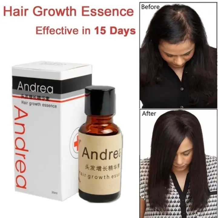 Andreahair Loss Fast Powerful Hair Repair Products In Hair Loss