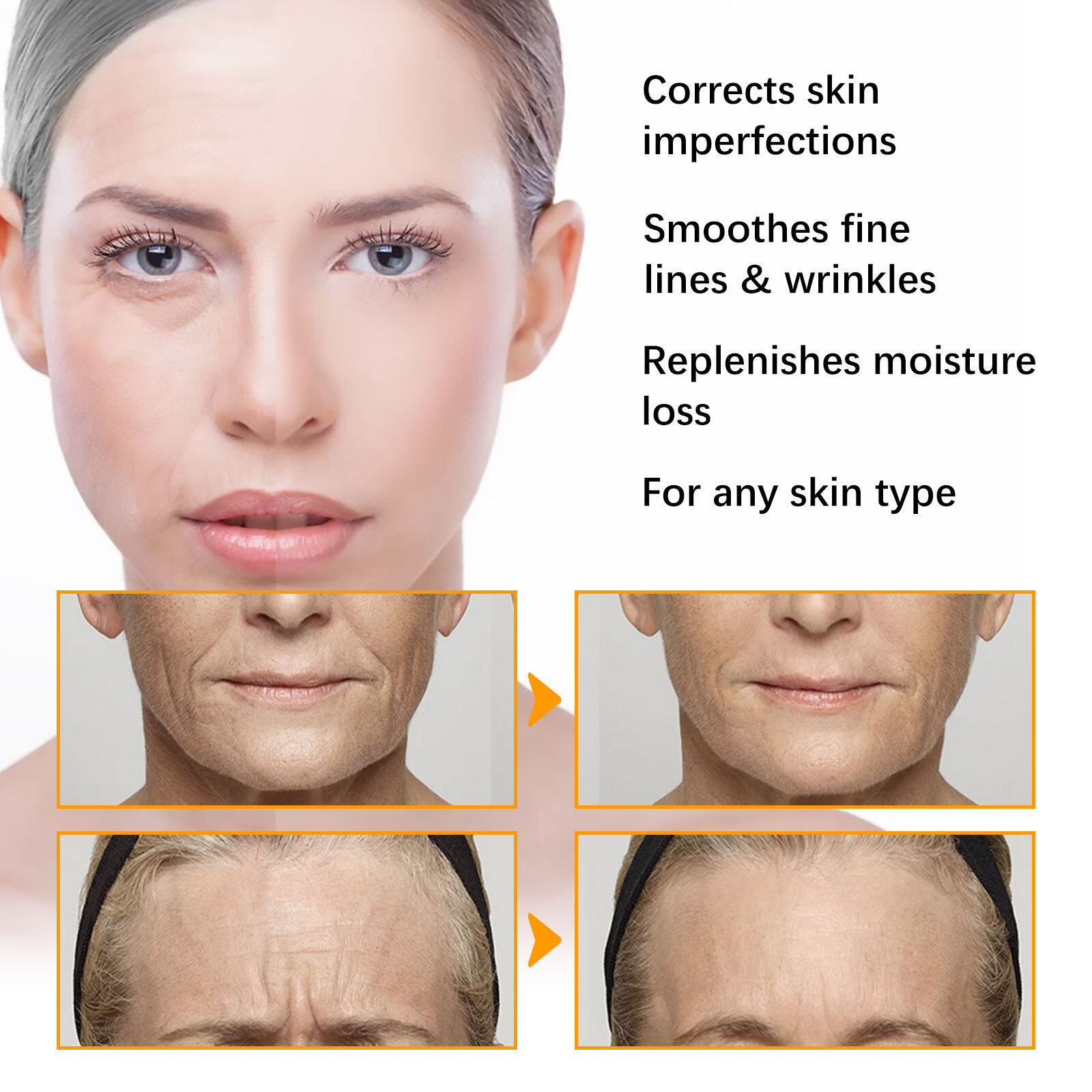 Jaysuing Turmeric Face Whitening Cream For Dark Skin Remove Acne face-whitening-beauty-cream-intense-skin-whitening-cream-100