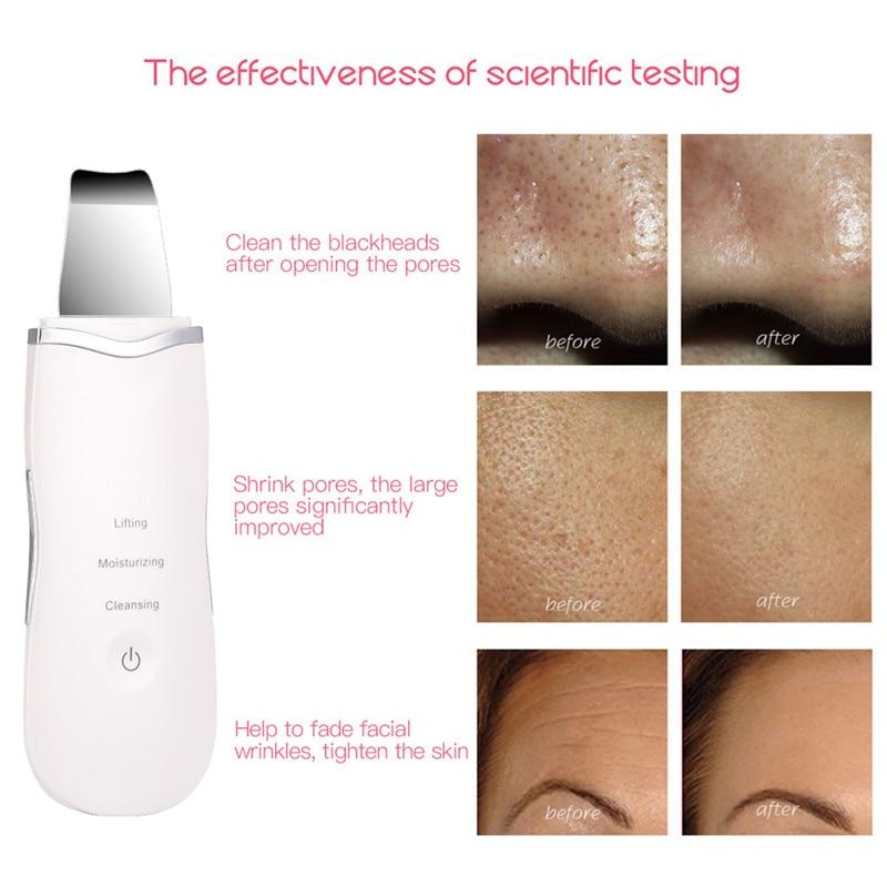 Professional Ultrasonic Facial Skin Scrubber Ion Deep Face Cleaning ...