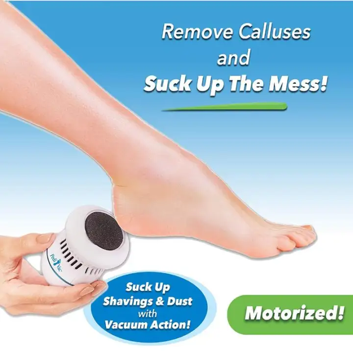 callus removal feet