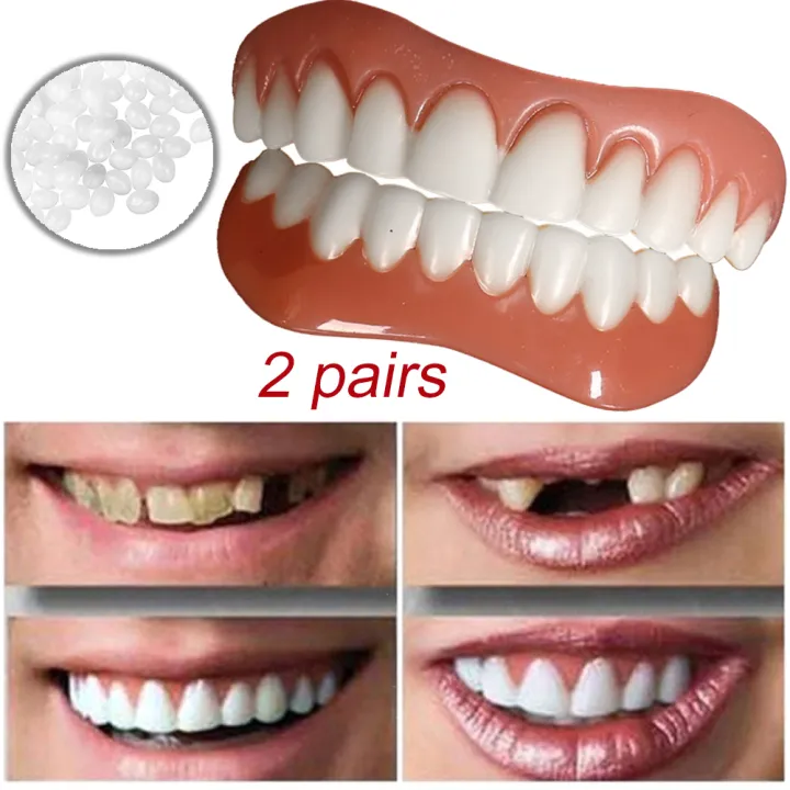 Hs 2 Pasang Veneer Senyum Instan Kosmetik Gigi Palsu Veneer Untuk Wanita Dan Pria Veneer Atas Dan Bawah Nyaman Lazada Indonesia