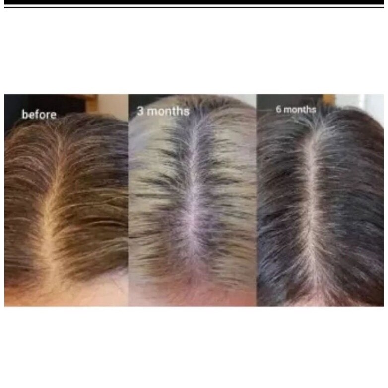 2022new The Ordinary Multi Peptide Serum for Hair Density Hair Growth Hair Grower Hair Care Essence to Repair Hair Loss 60ml | Lazada 2022new The Ordinary Multi Peptide Serum for Hair Density Hair Growth Hair Grower Hair Care Essence to Repair Hair Loss 60ml | Lazada