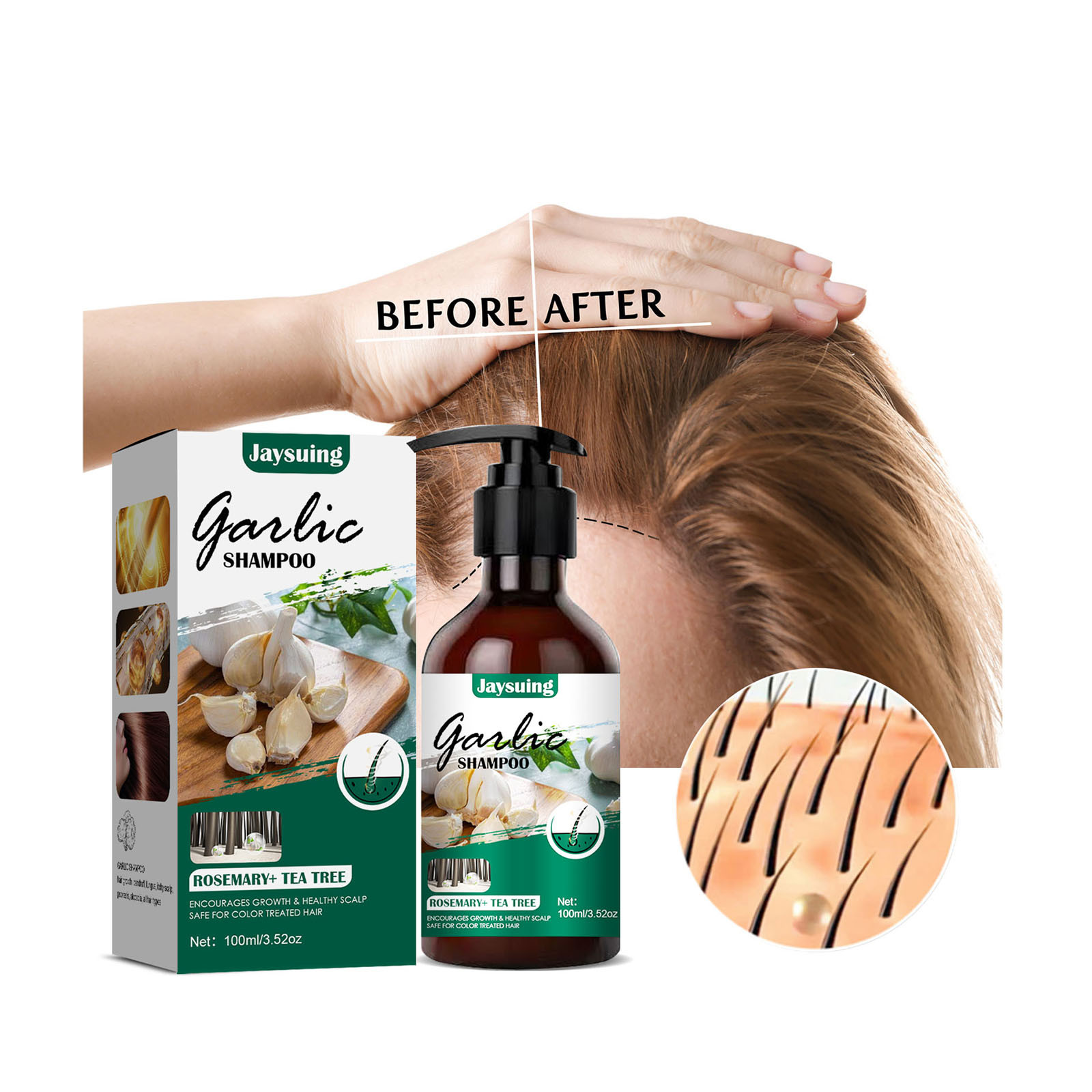 scalp-anti-dandruff-shampoothing-damaged-garlic-anti-dandruff-100ml