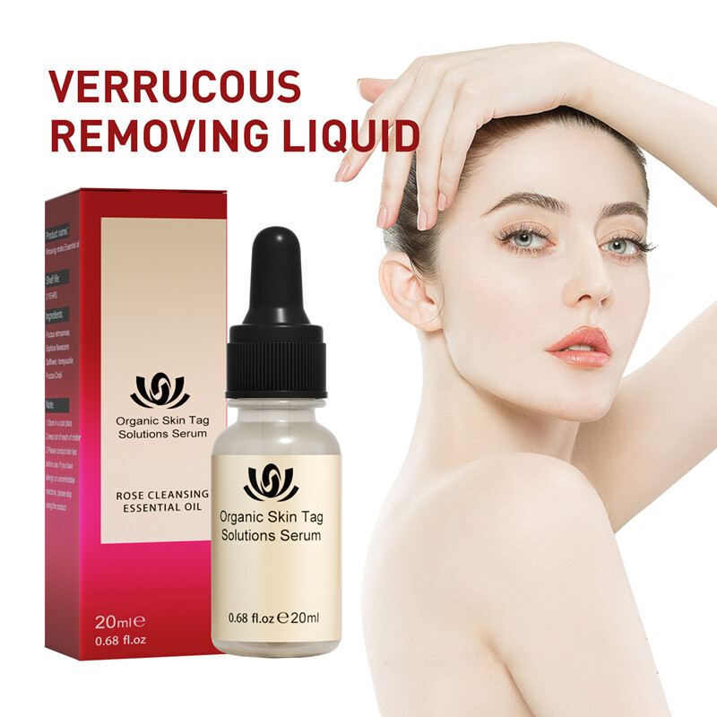 Skin Tag Remover Wart Remover Mole Remover Mole And Skin Tag Removal skin-tag-remover-wart-remover-mole-remover-mole-and-skin-tag-removal