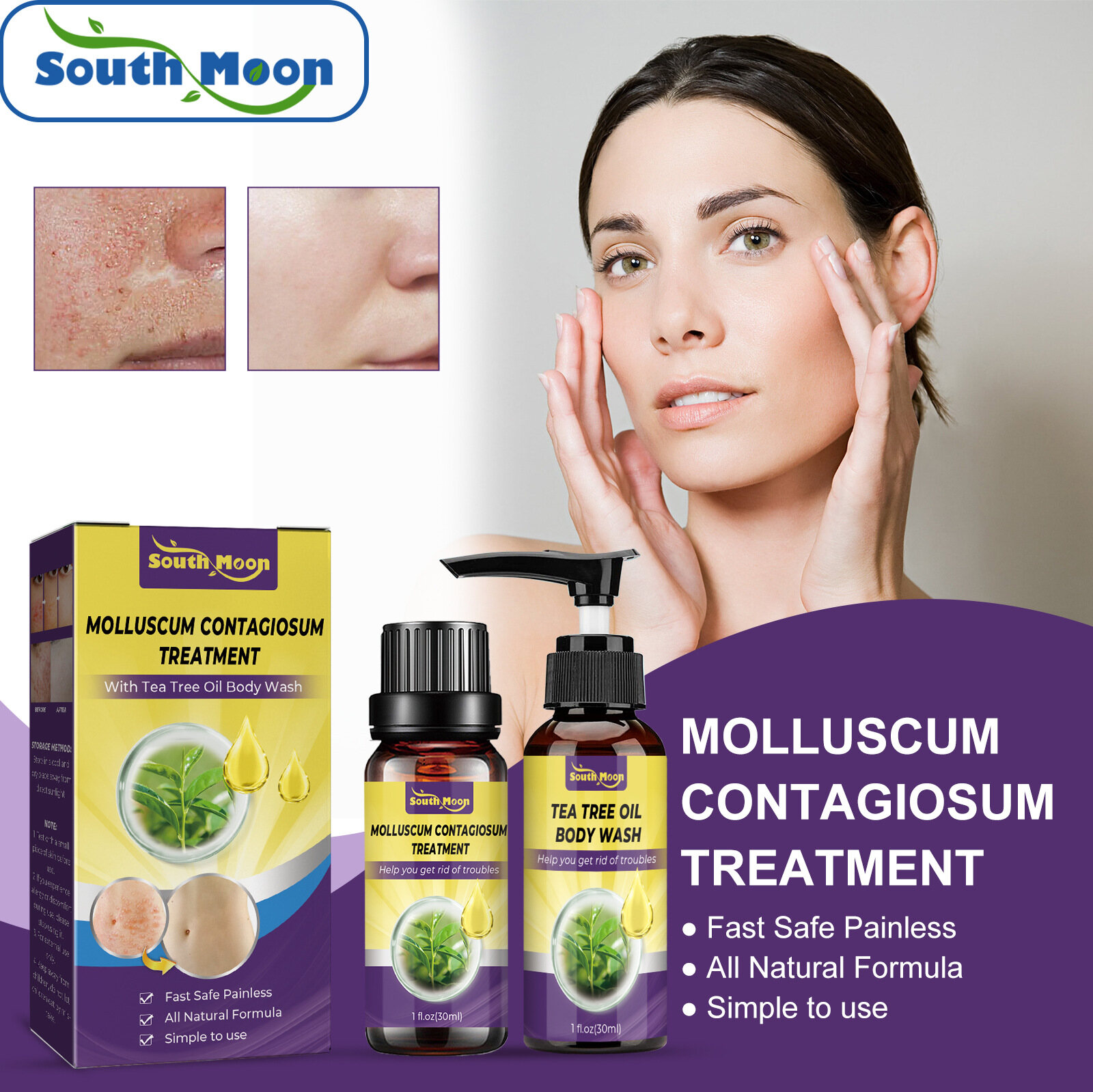 South Moon Verruca Removing Set Skin Cleaning and Removing Axillary Hand and Foot Verruca Removing Flat Special Care Liquid Set Acne Removal Serum Treatment Dark Spot Acne Scar Moisturizing Nourish Smooth Shrink Pores Whitening Face Peeling Serum