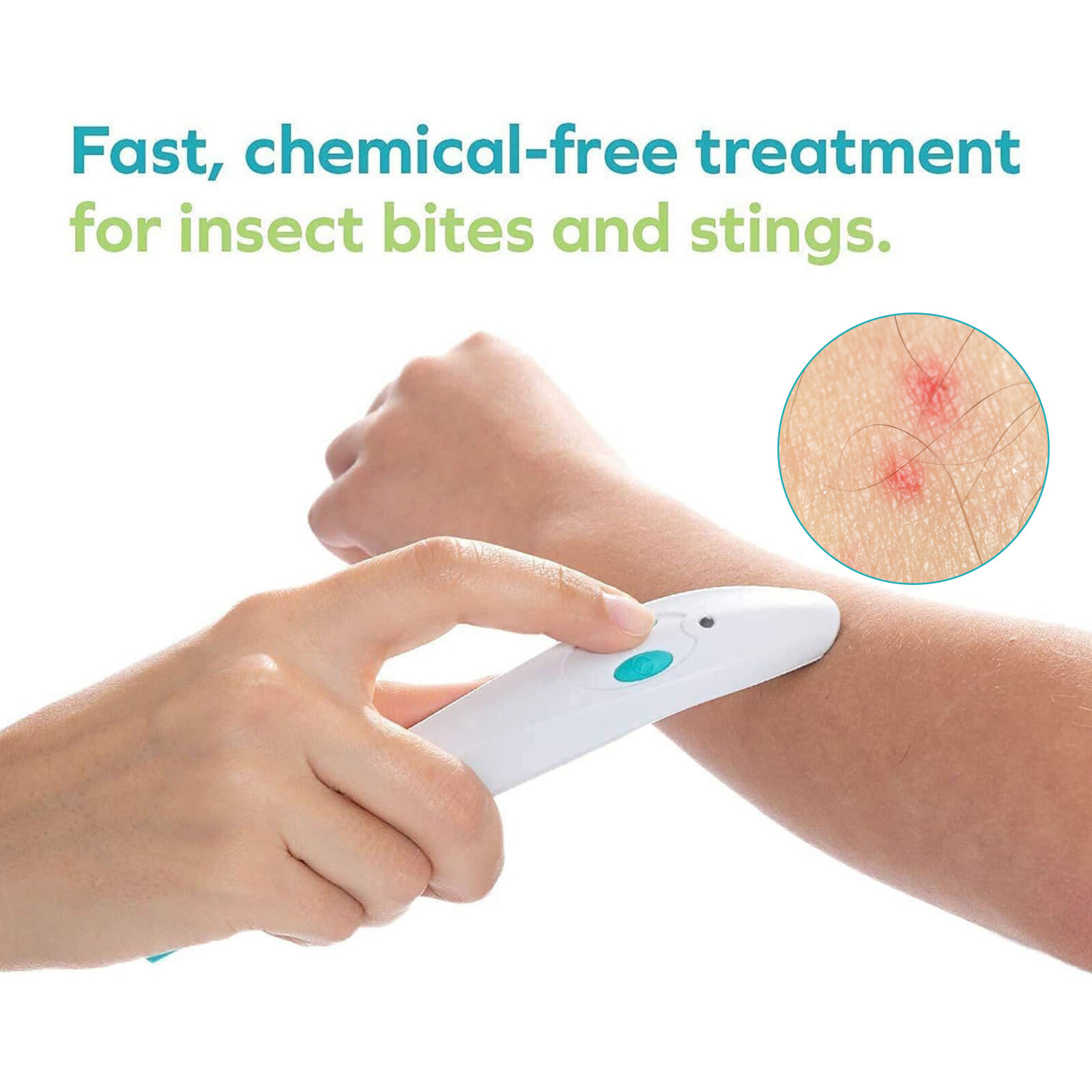 [Wondering] Mosquito Bite Itching Pen Compact Kid Friendly Vibration