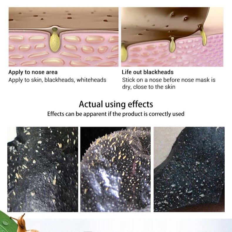, Mặt Nạ Lột Da Mặt