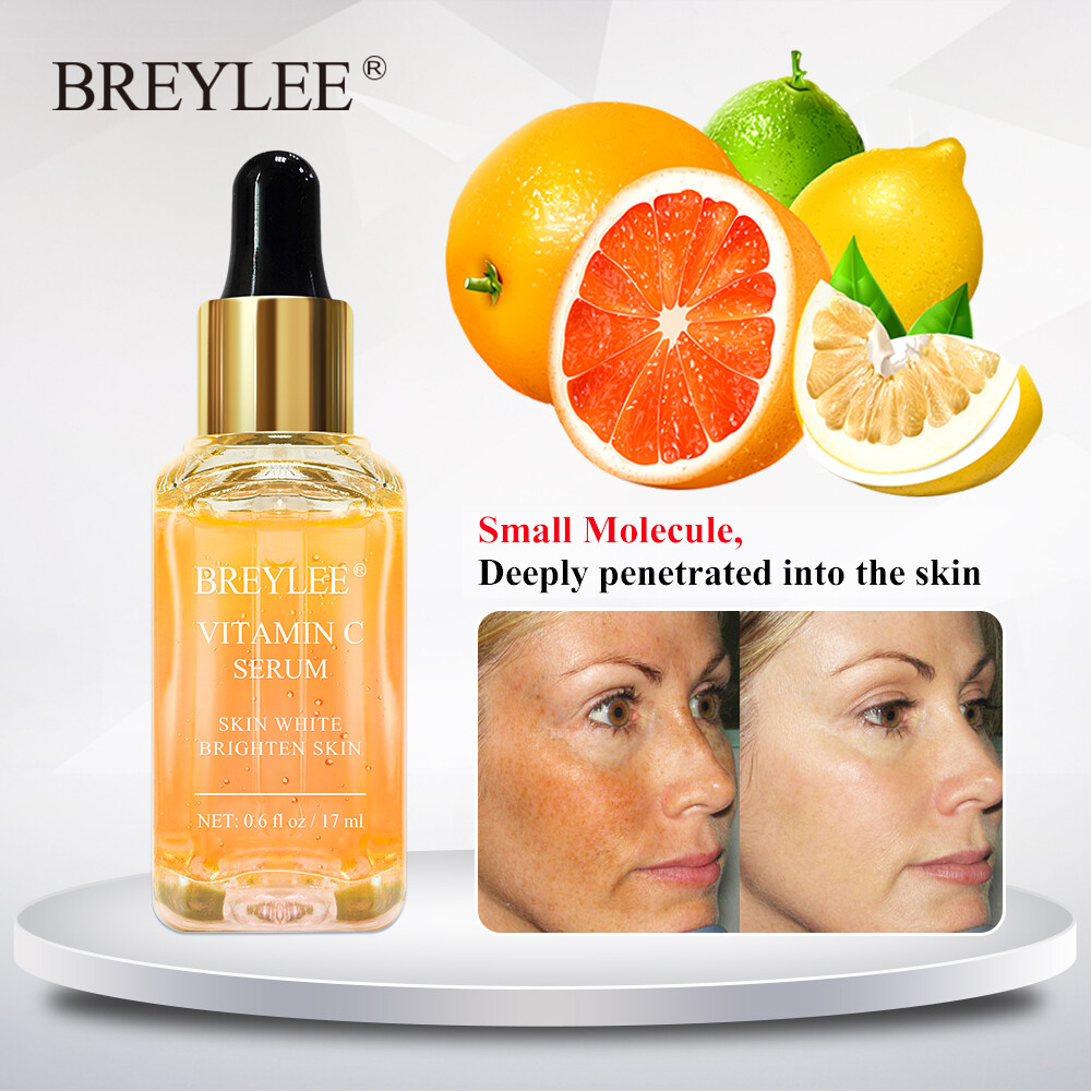 witch hazel face spray