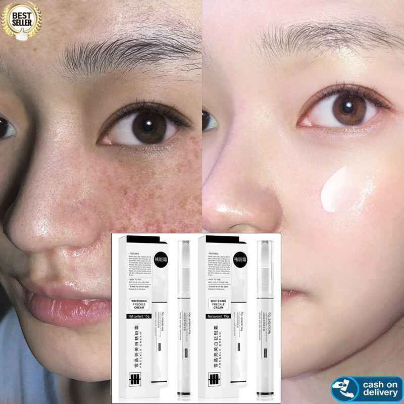 Spots And Tags Remover Serum Pigment Corrector Whitening Scar Cream Acne Anti Freckle Face Blemish Melanin Spots Remove Pen