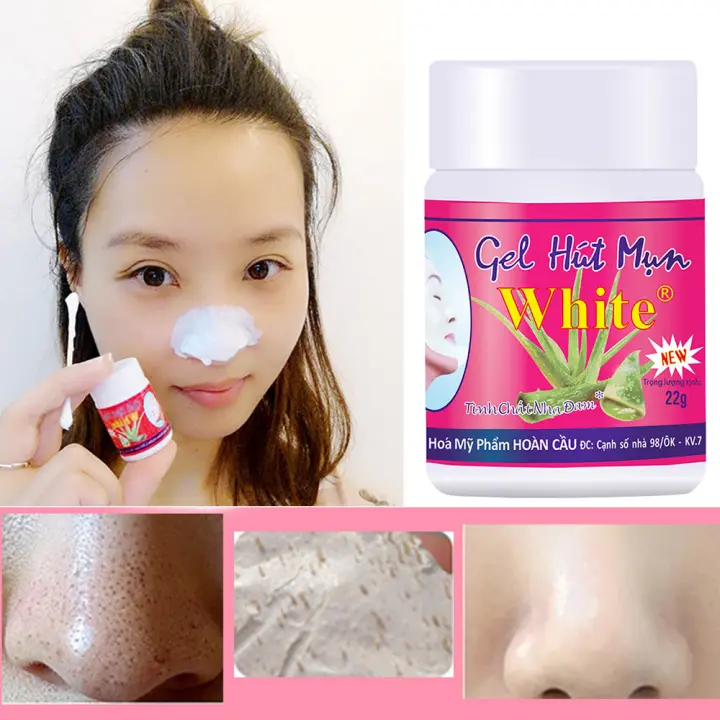 blackhead remover cream