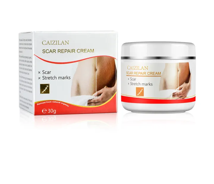 body stretch marks removal cream