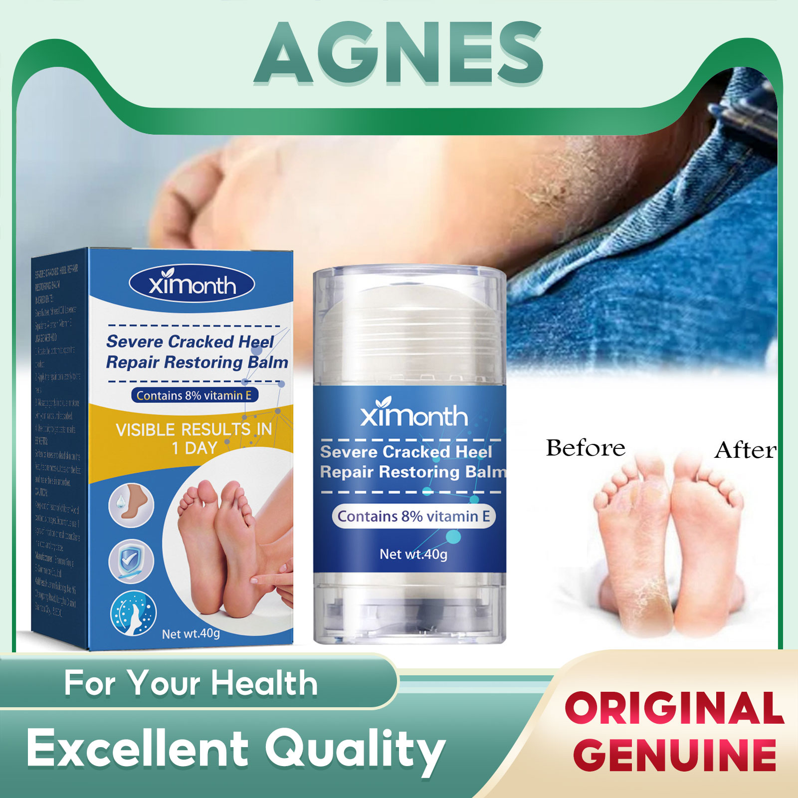 Ximonth Anti Cracking Foot Balm Stick Moisturizing Nourishing Severe Drying Cracked Dead Skin Removal Hand Feet Heel Crack Repair Cream Anti-Drying Crack Foot Cream Heel Cracked Moisturizing Repair Cream Cracking Dead Skin Heel Cracked Feet Care