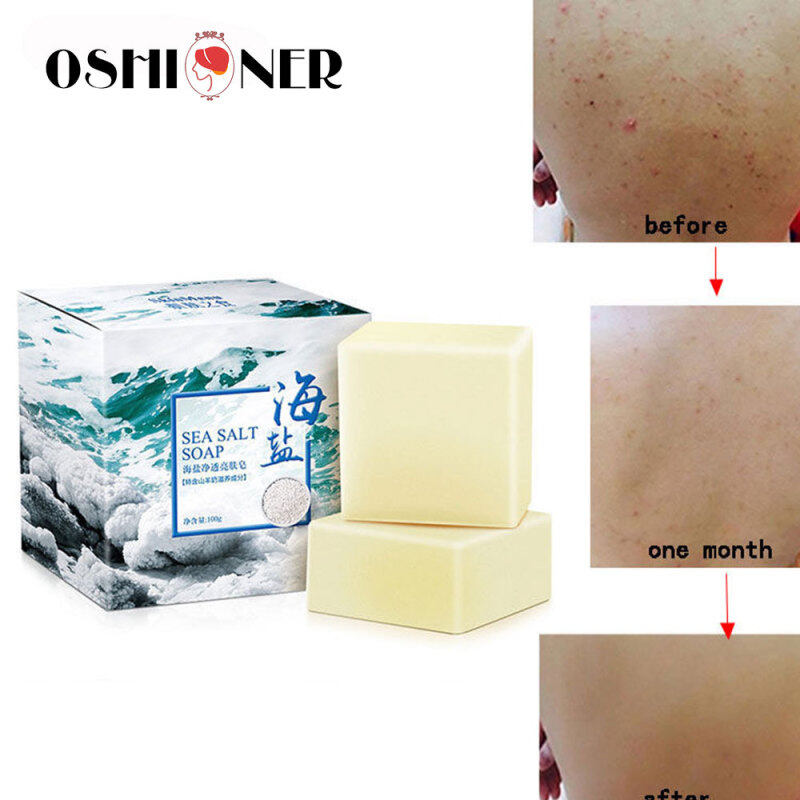 Xà Phòng Rửa Mặt Muối Biển 100G, Sữa Dê, Sữa Rửa Mặt, Trị Mụn, Mụn Nhọt, Lỗ Chân Lông giá rẻ