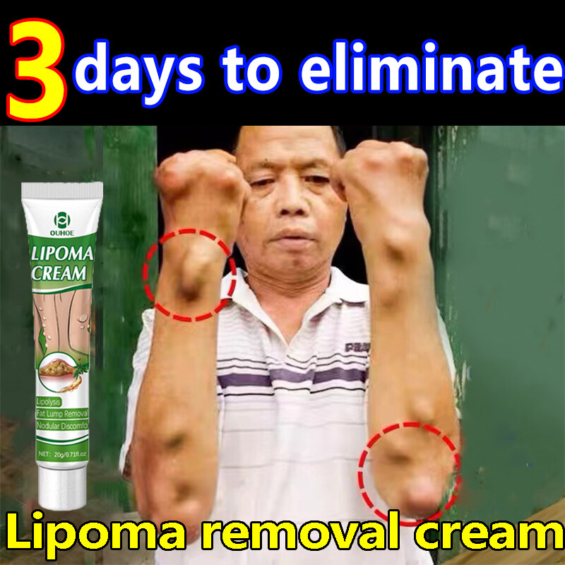 Lipoma Removal 20g Fat Lump Removal Dredge Dissipate Chinese Herbal
