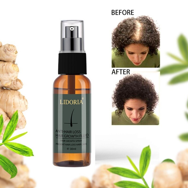 [LWF HOT] ♟卐 LIDORIA 30ml Hair Growth Essential Oil Essence Anti Hair