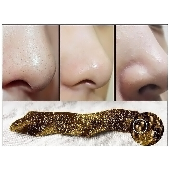 [Phòng khám 3W] Collagen vàng sang trọng Bóc gói 100ml
