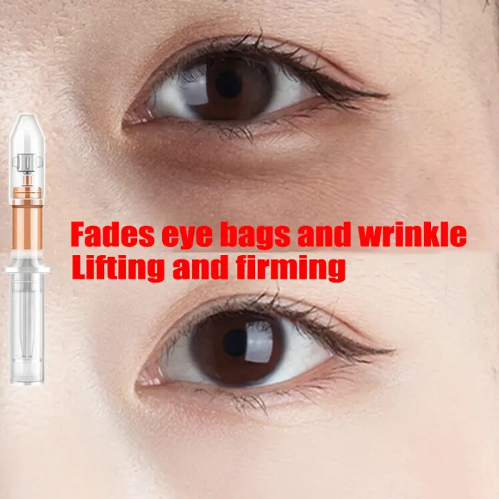 eye bag wrinkles