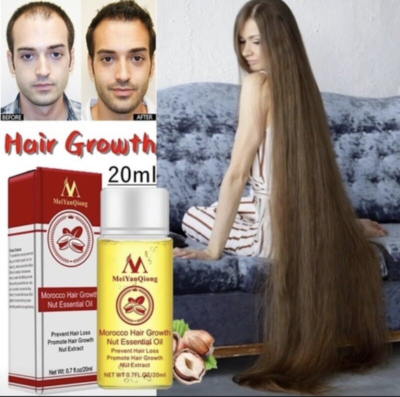 Tinh dầu mọc tóc meiyanqiong Dầu gừng Tóc dày Tinh chất sửa chữa trị rụng tóc Chống mọc nhanh Chất lỏng 20ml