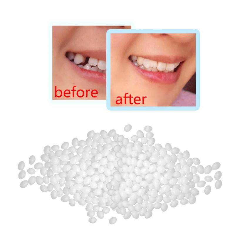 Temporary Tooth Repair Kit Teeth And Gaps FalseTeeth Solid Glue Denture Adhesive
