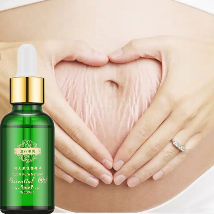 stretch mark healing cream