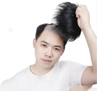 Men S Hair Patch Real Hair Silk Head Patch Forehead Baldness Patch