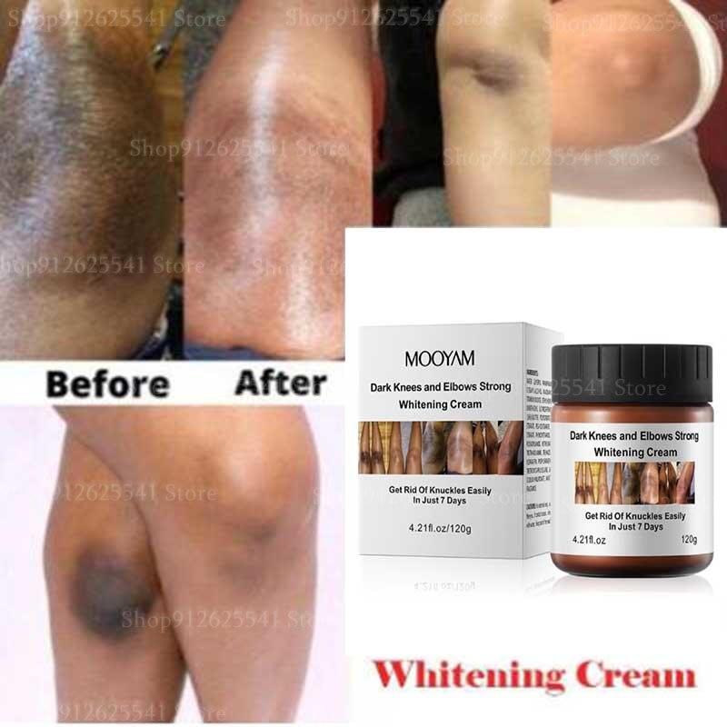 Strong Effective Dark Knuckles Remover Serum Powerful Whitening Cream